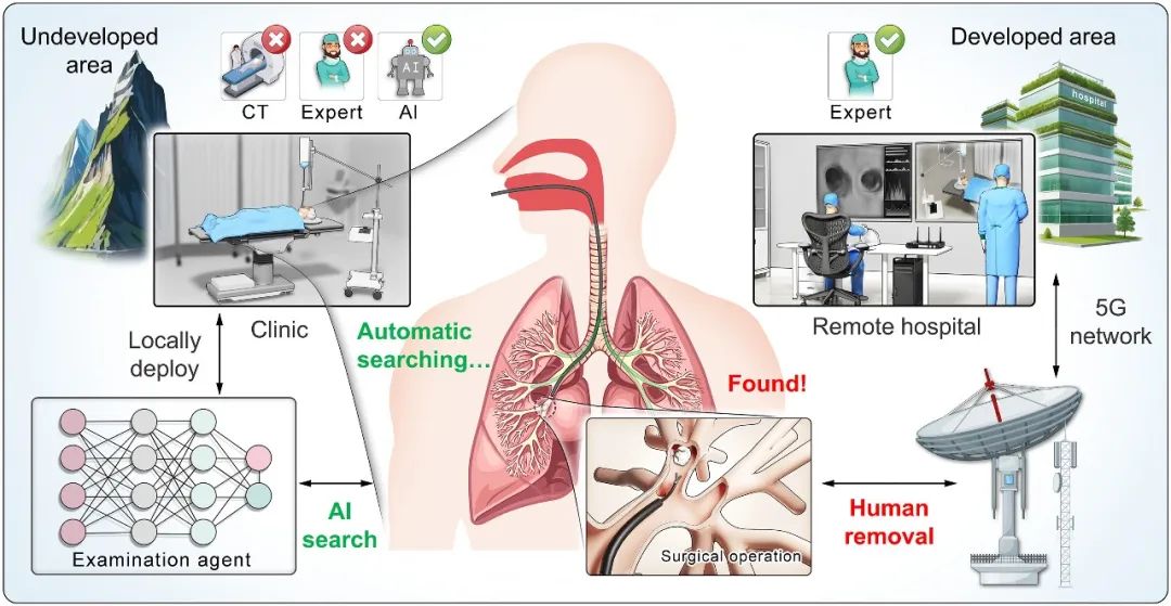 可远程急救！浙大Science子刊发表AI支气管镜机器人，基层福音！